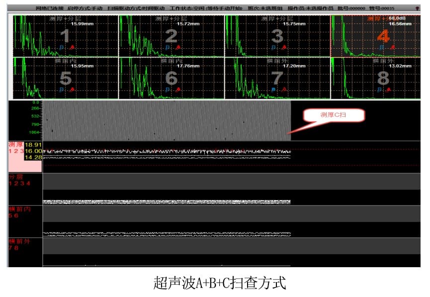 扫查方式.jpg